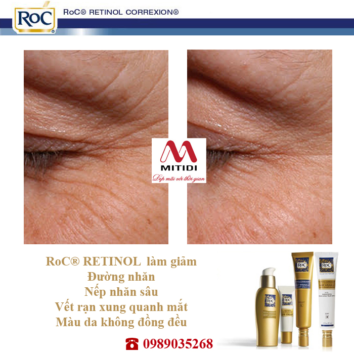 Kem RoC Retinol Correxion Deep Wrinkle Mitidi-chong-lao-hoa-xoa-nep-nhan-15.jpg (334 KB)
